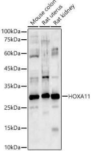 Western blot analysis of various lysates, using Anti-HOXA11 Antibody (A9119) at 1:1,000 dilution The secondary antibody was Goat Anti-Rabbit IgG H&L Antibody (HRP) at 1:10,000 dilution Lysates/proteins were present at 25 µg per lane