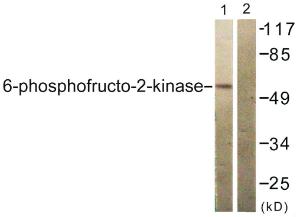 Western blot analysis of lysates from 293 cells, treated with Heat shock using Anti-PFKFB2 Antibody. The right hand lane represents a negative control, where the antibody is blocked by the immunising peptide