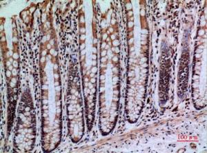 Antibody anti-PTPRJ 100 µg