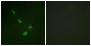 Immunofluorescence analysis of NIH/3T3 cells using Anti-ERK8 Antibody. The right hand panel represents a negative control, where the antibody was pre-incubated with the immunising peptide