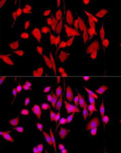 Immunofluorescence analysis of PC-12 cells using Anti-ERK1 + ERK2 Antibody [ARC0212] (A306245) at a dilution of 1:50 (40x lens). DAPI was used to stain the cell nuclei (blue).