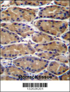 Anti-UPRT Rabbit Polyclonal Antibody (AP (Alkaline Phosphatase))