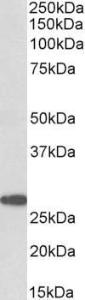 Anti-PTGDS Antibody (A83525) (0.3 µg/ml) staining of Human Cerebellum lysate (35 µg protein in RIPA buffer). Primary incubation was 1 hour. Detected by chemiluminescence