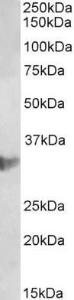 Anti-CLIC1 Antibody (A85189) (2µg/ml) staining of U937 lysate (35µg protein in RIPA buffer). Primary incubation was 1 hour. Detected by chemiluminescence.