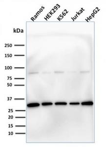 Western blot analysis of human Ramos, HEK293, K562, Jurkat, and HepG2 cell lysates using Anti-Prohibitin Antibody [PHB/1881]