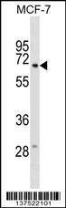 Anti-GGT6 Rabbit Polyclonal Antibody (AP (Alkaline Phosphatase))