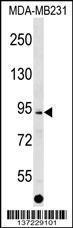 Anti-ALS2CL Rabbit Polyclonal Antibody (AP (Alkaline Phosphatase))