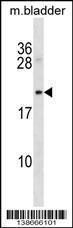 Anti-Mycb Rabbit Polyclonal Antibody (FITC (Fluorescein Isothiocyanate))