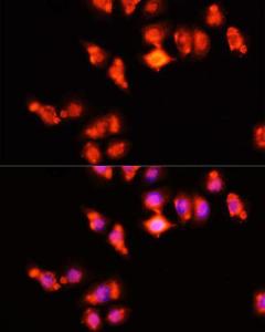 Immunofluorescence analysis of HeLa cells using Anti-HOXA11 Antibody (A9119) at a dilution of 1:100 (40x lens) DAPI was used to stain the cell nuclei (blue)