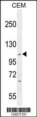 Anti-IFT88 Rabbit Polyclonal Antibody