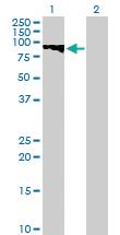 Anti-GTSE1 Mouse Polyclonal Antibody