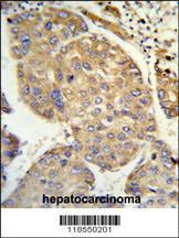 Anti-PHACTR2 Rabbit Polyclonal Antibody