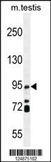 Anti-IFT88 Rabbit Polyclonal Antibody