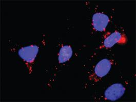 Anti-TRAF2 + HSPA1L Antibody Pair