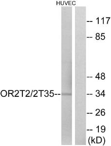 Western blot analysis of lysates from HUVEC cells using Anti-OR2T2 + OR2T35 Antibody The right hand lane represents a negative control, where the antibody is blocked by the immunising peptide