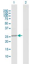 Anti-GAMT Rabbit Polyclonal Antibody