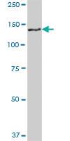 Anti-GTSE1 Mouse Polyclonal Antibody