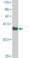 Anti-CSRNP3 Mouse Polyclonal Antibody