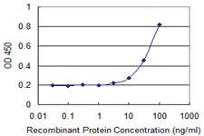 Anti-GAMT Mouse Monoclonal Antibody [clone: 3H4]