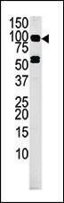 Anti-MARK4 Rabbit Polyclonal Antibody (Biotin)