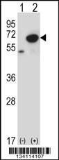 Anti-PNKP Rabbit Polyclonal Antibody (PE (Phycoerythrin))