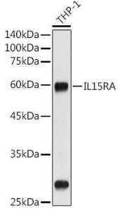 Anti-IL-15RA antibody