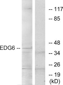 Anti-EDG6 antibody