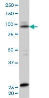 Anti-SRPK1 Mouse Monoclonal Antibody [clone: 2E8]