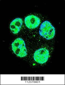 Anti-METTL2B Rabbit Polyclonal Antibody (FITC (Fluorescein Isothiocyanate))