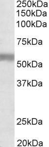 Anti-NPR3 Antibody (A83527) (1 µg/ml) staining of Human Placenta lysate (35 µg protein in RIPA buffer) Primary incubation was 1 hour Detected by chemiluminescence