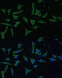 Immunofluorescence analysis of L929 cells using Anti-HIBCH Antibody (A93236) at a dilution of 1:100. DAPI was used to stain the cell nuclei (blue)