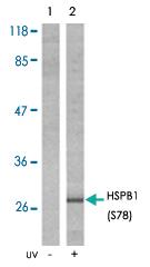 Anti-HSPB1 Rabbit Polyclonal Antibody