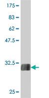 Anti-TGFA Mouse Polyclonal Antibody