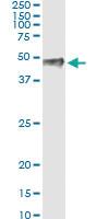 Anti-PITX1 Antibody Pair