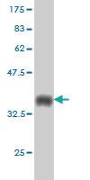 Anti-RCC1 Mouse Monoclonal Antibody [clone: 2F1]