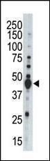 Anti-AURKB Rabbit Polyclonal Antibody (Biotin)