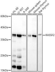 Western blot analysis of extracts of various cell lines, using Anti-RASSF2 Antibody [ARC2868] (A306246) at 1:500 dilution