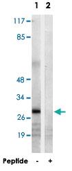 Anti-MRPL9 Rabbit Polyclonal Antibody