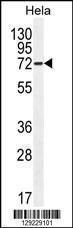 Anti-ATG7 Rabbit Polyclonal Antibody (Biotin)