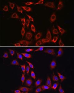 Anti-IL-15RA antibody