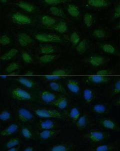 Immunofluorescence analysis of U-2 OS cells using Anti-HIBCH Antibody (A93236) at a dilution of 1:100. DAPI was used to stain the cell nuclei (blue)