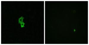 Anti-EDG6 antibody