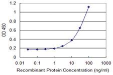 Anti-PNPLA6 Mouse Monoclonal Antibody [clone: 3D10]