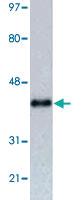 Anti-RFP tag Mouse Monoclonal Antibody [clone: 465d3]