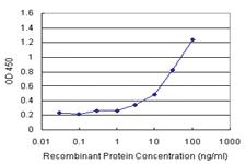 Anti-VIL1 Antibody Pair