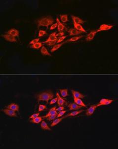 Anti-IL-15RA antibody