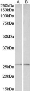 Anti-PRDX6 Antibody (A85193) (01 µg/ml) staining of Liver (A) and Heart (B) lysates (35 µg protein in RIPA buffer) Primary incubation was 1 hour Detected by chemiluminescence