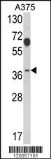 Anti-PSMD7 Rabbit Polyclonal Antibody