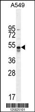 Anti-TNFRSF1A Rabbit Polyclonal Antibody