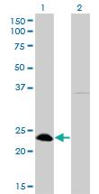 Anti-NFYB Mouse Monoclonal Antibody [clone: 6H6]